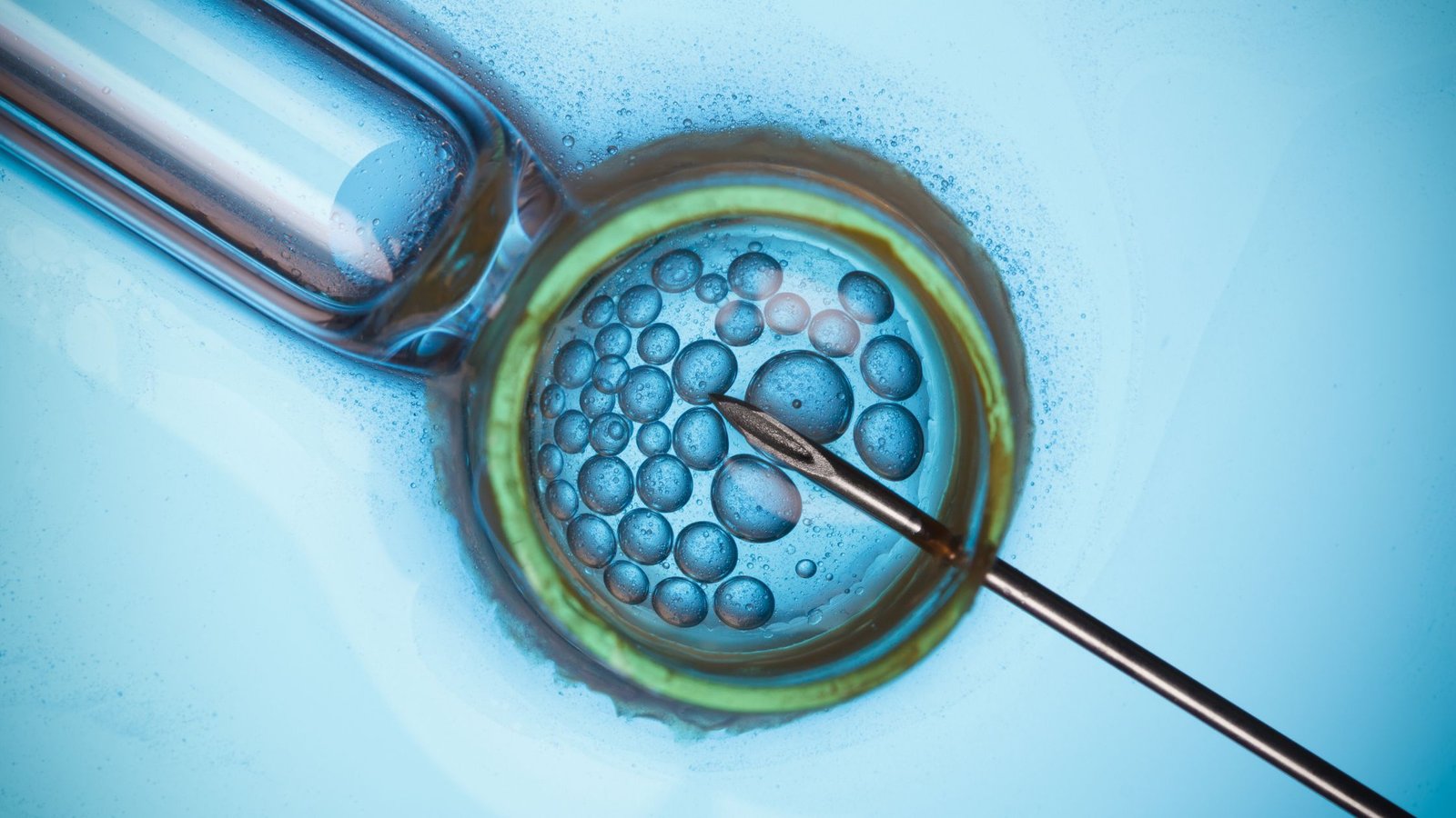 What’s Next in Test-Tube Baby Treatment? Exploring the Latest Advancements